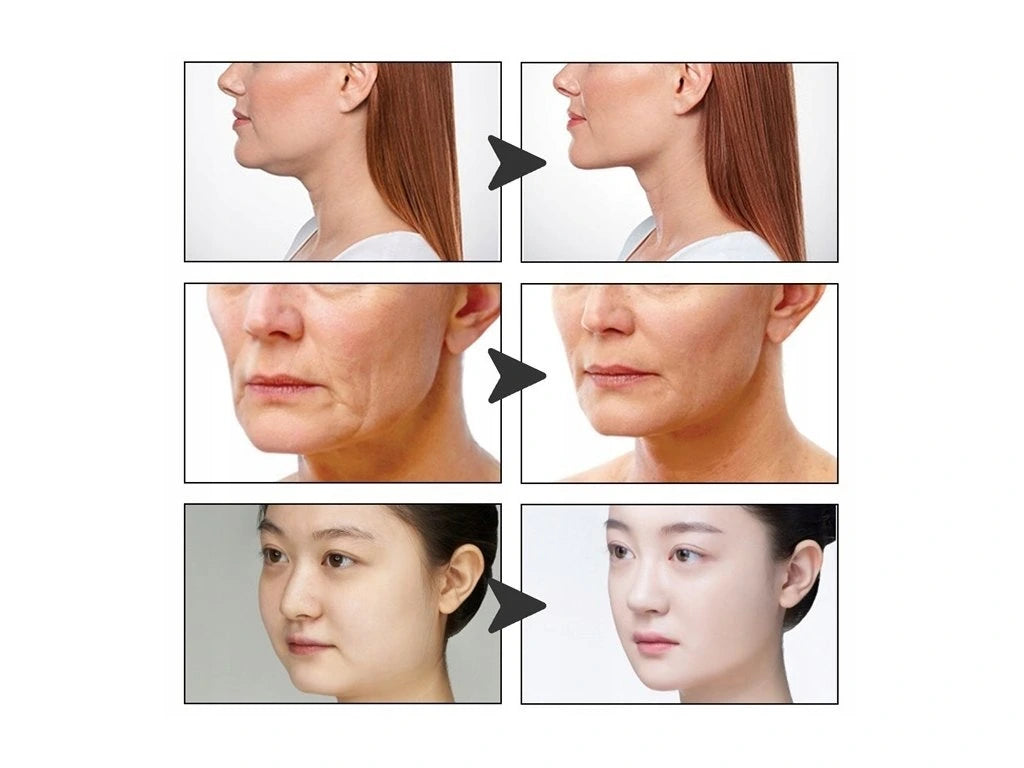 Lift Invisibil Rapid